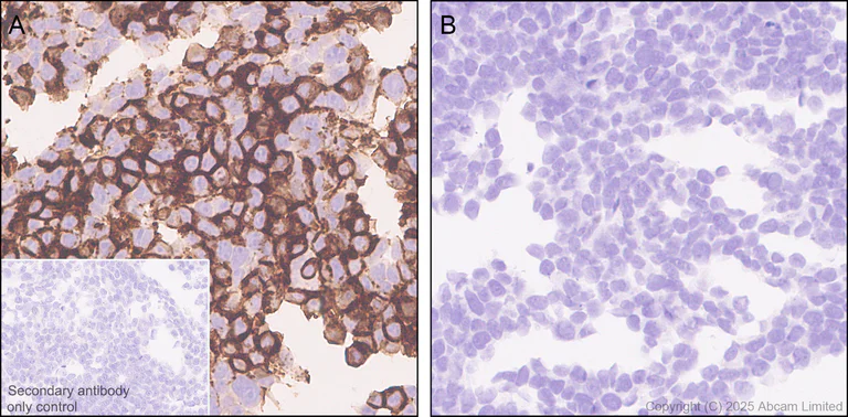Immunohistochemistry (Formalin/PFA-fixed paraffin-embedded sections) - Anti-CD64 antibody [EPR26480-569] - BSA and Azide free (AB325955)