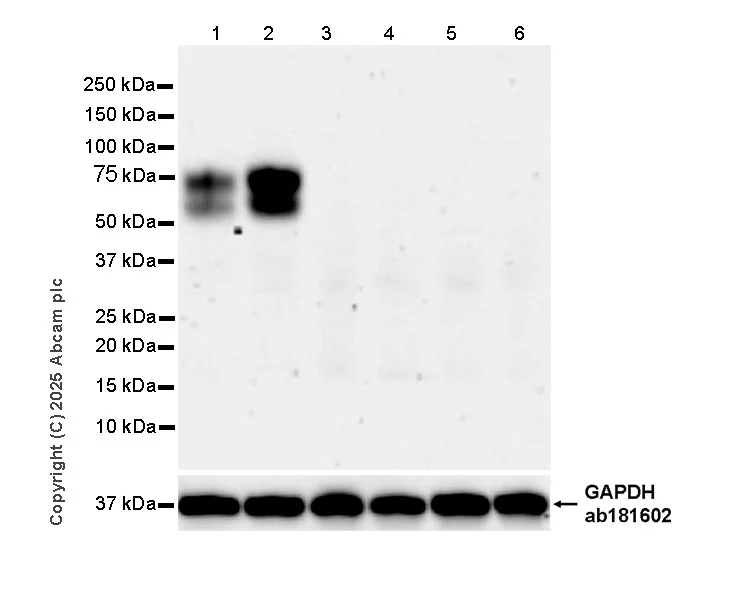 Western blot - Anti-CD64 antibody [EPR26480-569] - BSA and Azide free (AB325955)