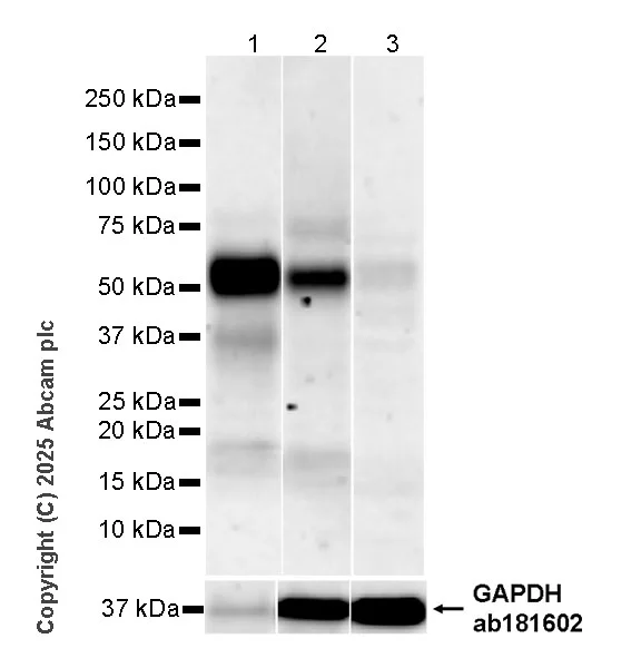 Western blot - Anti-CD64 antibody [EPR26480-569] - BSA and Azide free (AB325955)