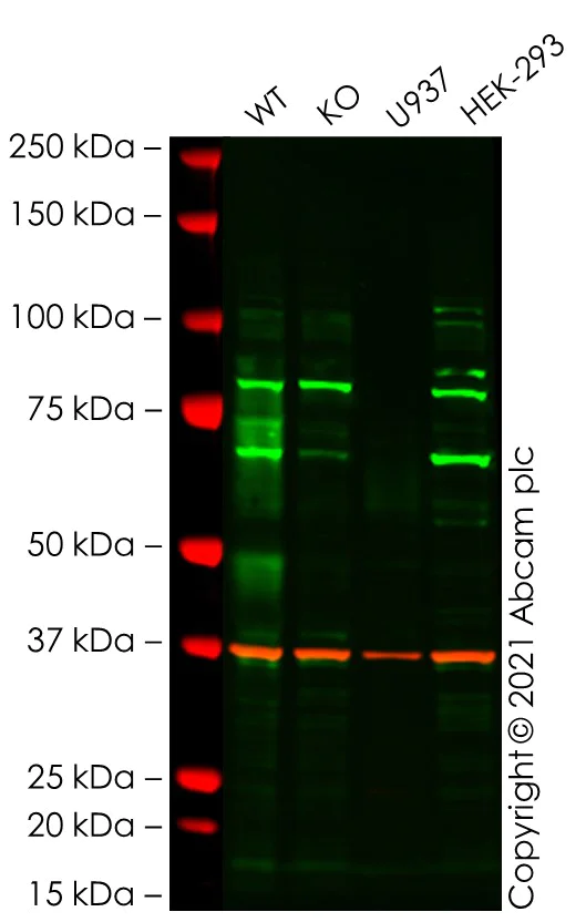 Western blot - Anti-CD64 antibody [EPR4623] (AB109449)