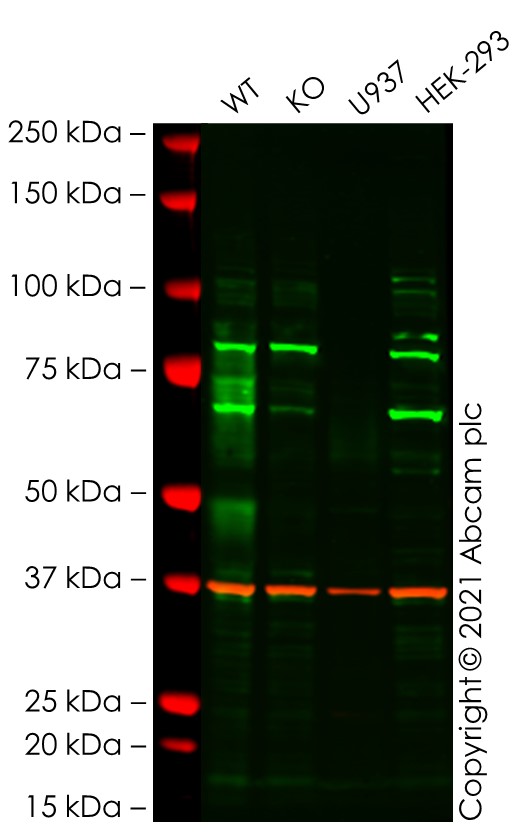 Western blot - Anti-CD64 antibody [EPR4623] - BSA and Azide free (AB216856), expandable thumbnail