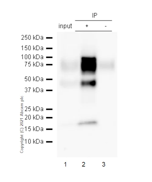Immunoprecipitation - Anti-CD64 antibody [EPR4624] - BSA and Azide free (AB216857)