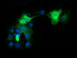 Immunocytochemistry/ Immunofluorescence - Anti-CD64 antibody [OTI3D3] (AB140779), expandable thumbnail