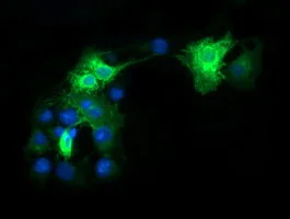 Immunocytochemistry/ Immunofluorescence - Anti-CD64 antibody [OTI3D3] (AB140779)