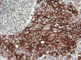 Immunohistochemistry (Formalin/PFA-fixed paraffin-embedded sections) - Anti-CD64 antibody [OTI3D3] (AB140779), expandable thumbnail
