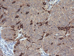 Immunohistochemistry (Formalin/PFA-fixed paraffin-embedded sections) - Anti-CD64 antibody [OTI3D3] (AB140779), expandable thumbnail
