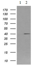 Western blot - Anti-CD64 antibody [OTI3D3] (AB140779), expandable thumbnail