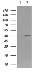 Western blot - Anti-CD64 antibody [OTI3D3] (AB140779)