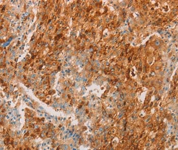 Immunohistochemistry (Formalin/PFA-fixed paraffin-embedded sections) - Anti-CD66b antibody (AB197678), expandable thumbnail