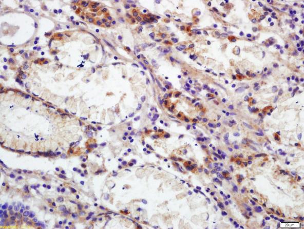 Immunohistochemistry (Formalin/PFA-fixed paraffin-embedded sections) - Anti-CD66b antibody (AB214175), expandable thumbnail