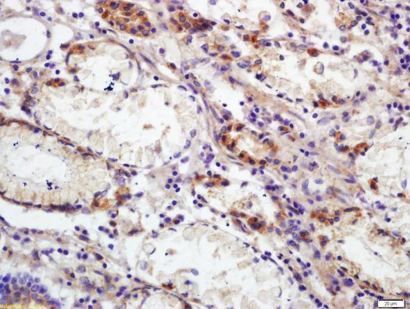 Immunohistochemistry (Formalin/PFA-fixed paraffin-embedded sections) - Anti-CD66b antibody (AB214175)