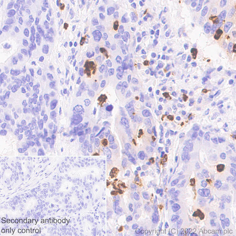 Immunohistochemistry (Formalin/PFA-fixed paraffin-embedded sections) - Anti-CD66b antibody [EPR25354-2] (AB300122)