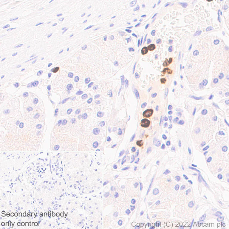 Immunohistochemistry (Formalin/PFA-fixed paraffin-embedded sections) - Anti-CD66b antibody [EPR25354-2] (AB300122)