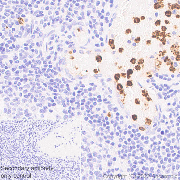 Immunohistochemistry (Formalin/PFA-fixed paraffin-embedded sections) - Anti-CD66b antibody [EPR25354-2] (BSA and Azide free) (AB300123)