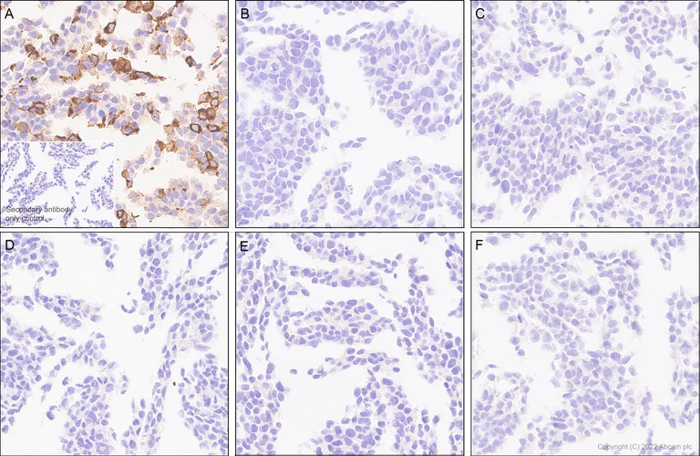 Immunohistochemistry (Formalin/PFA-fixed paraffin-embedded sections) - Anti-CD66b antibody [EPR25354-2] (BSA and Azide free) (AB300123)