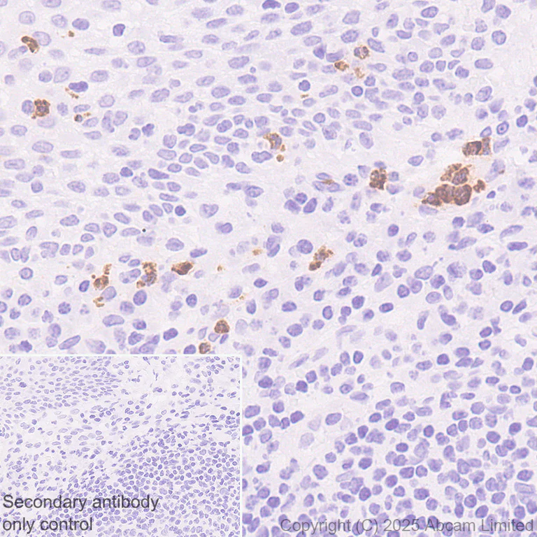 Immunohistochemistry (Formalin/PFA-fixed paraffin-embedded sections) - Anti-CD66b antibody [RM1323] (AB325777)