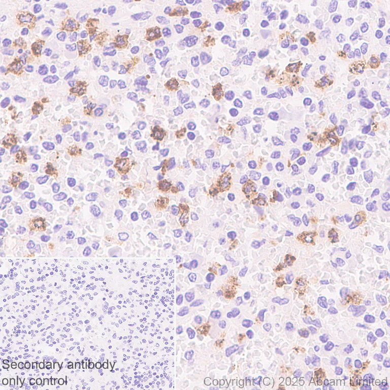Immunohistochemistry (Formalin/PFA-fixed paraffin-embedded sections) - Anti-CD66b antibody [RM1323] (AB325777)
