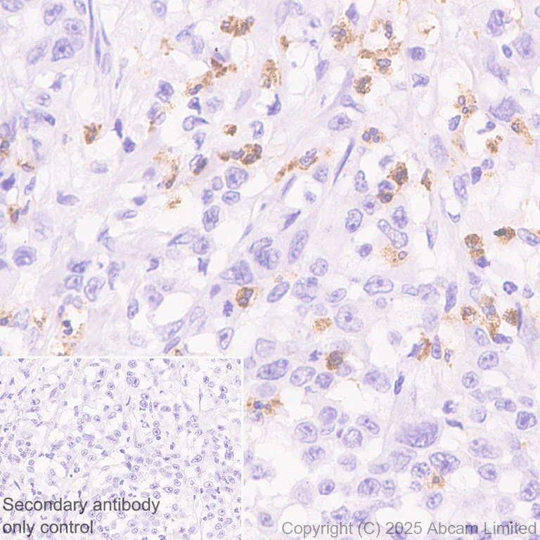 Immunohistochemistry (Formalin/PFA-fixed paraffin-embedded sections) - Anti-CD66b antibody [RM1323] (AB325777)