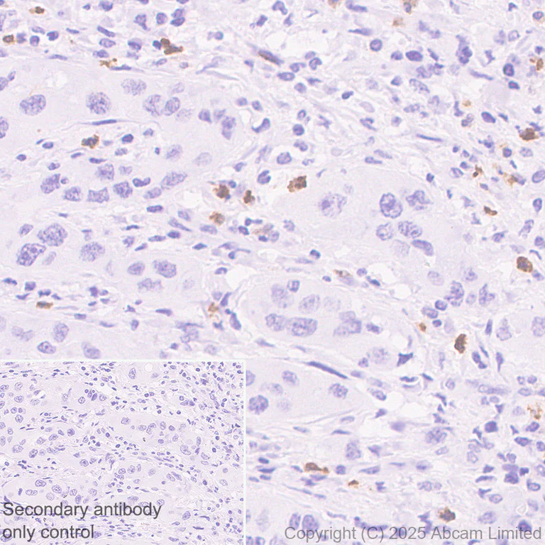 Immunohistochemistry (Formalin/PFA-fixed paraffin-embedded sections) - Anti-CD66b antibody [RM1323] (AB325777)