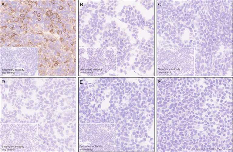 Immunohistochemistry (Formalin/PFA-fixed paraffin-embedded sections) - Anti-CD66b antibody [RM1323] (AB325777)
