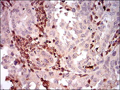 Immunohistochemistry (Formalin/PFA-fixed paraffin-embedded sections) - Anti-CD68 antibody [3F7D3] (AB201973)
