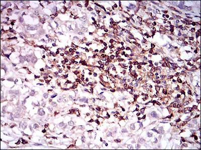 Immunohistochemistry (Formalin/PFA-fixed paraffin-embedded sections) - Anti-CD68 antibody [3F7D3] (AB201973)