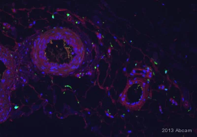 Immunohistochemistry (Formalin/PFA-fixed paraffin-embedded sections) - Anti-CD68 antibody (AB125047)