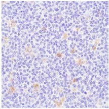 Immunohistochemistry (Formalin/PFA-fixed paraffin-embedded sections) - Anti-CD68 antibody (AB125157)