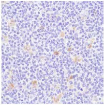 Immunohistochemistry (Formalin/PFA-fixed paraffin-embedded sections) - Anti-CD68 antibody (AB125157)