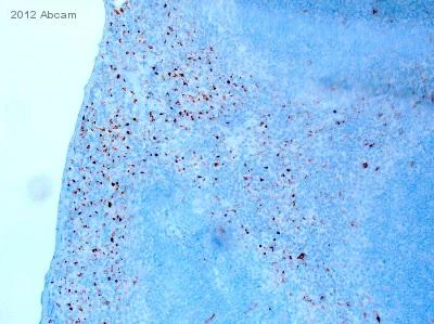 Immunohistochemistry (Formalin/PFA-fixed paraffin-embedded sections) - Anti-CD68 antibody (AB125212)