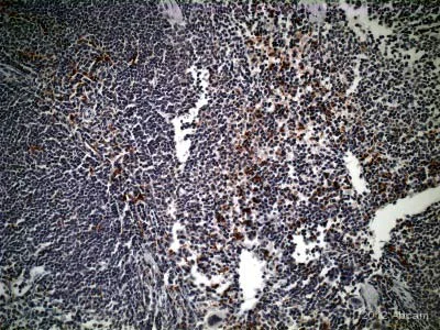 Immunohistochemistry (Formalin/PFA-fixed paraffin-embedded sections) - Anti-CD68 antibody (AB125212)