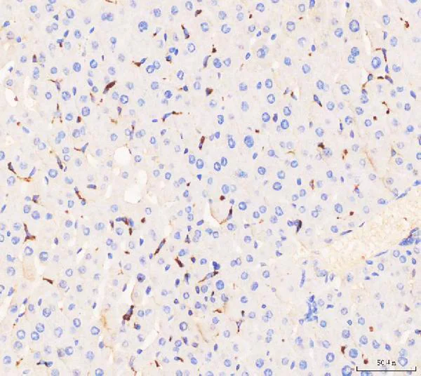 Immunohistochemistry (Formalin/PFA-fixed paraffin-embedded sections) - Anti-CD68 antibody (AB125212)