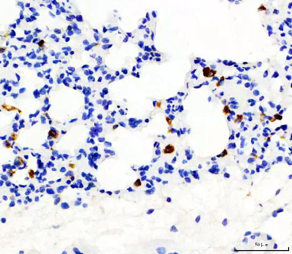 Immunohistochemistry (Formalin/PFA-fixed paraffin-embedded sections) - Anti-CD68 antibody (AB125212)