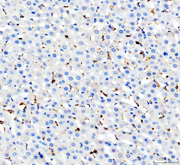 Immunohistochemistry (Formalin/PFA-fixed paraffin-embedded sections) - Anti-CD68 antibody (AB125212)