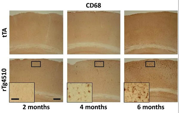 Immunohistochemistry (Formalin/PFA-fixed paraffin-embedded sections) - Anti-CD68 antibody (AB125212)