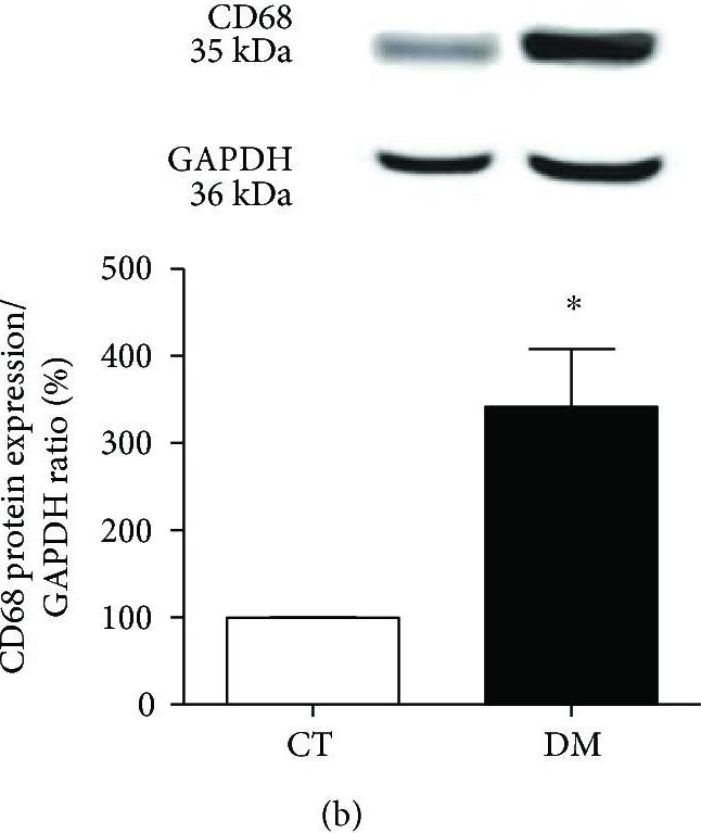 Western blot - Anti-CD68 antibody (ab125212), expandable thumbnail