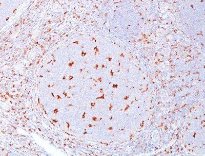 Immunohistochemistry (Formalin/PFA-fixed paraffin-embedded sections) - Anti-CD68 antibody [C68/684] (AB201340)