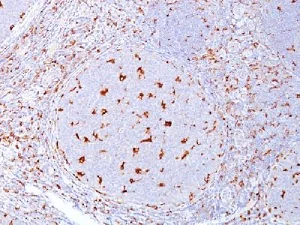 Immunohistochemistry (Formalin/PFA-fixed paraffin-embedded sections) - Anti-CD68 antibody [C68/684] - BSA and Azide free (AB213098)