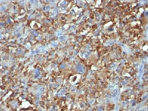 Immunohistochemistry (Formalin/PFA-fixed paraffin-embedded sections) - Anti-CD68 antibody [C68/684] - BSA and Azide free (AB213098)