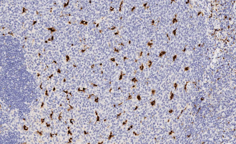 Immunohistochemistry (Formalin/PFA-fixed paraffin-embedded sections) - Anti-CD68 antibody [EPR20545] (AB213363)