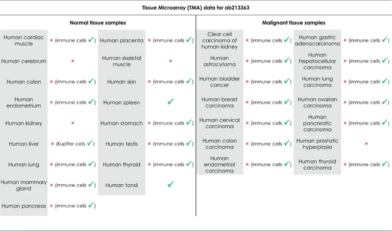 Immunohistochemistry (Formalin/PFA-fixed paraffin-embedded sections) - Anti-CD68 antibody [EPR20545] (AB213363)