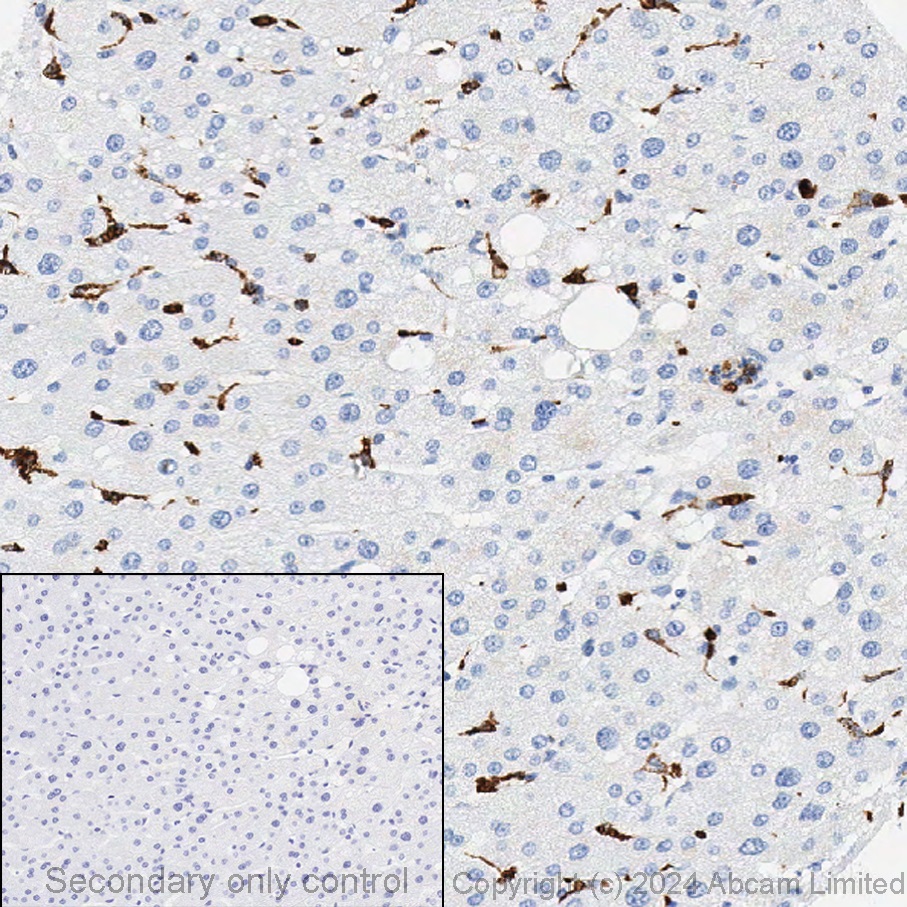 Immunohistochemistry (Formalin/PFA-fixed paraffin-embedded sections) - Anti-CD68 antibody [EPR20545] (ab213363), expandable thumbnail