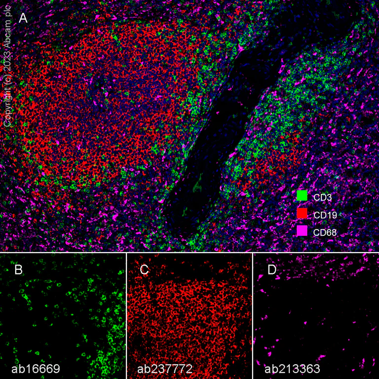 Multiplex immunohistochemistry - Anti-CD68 antibody [EPR20545] (AB213363)