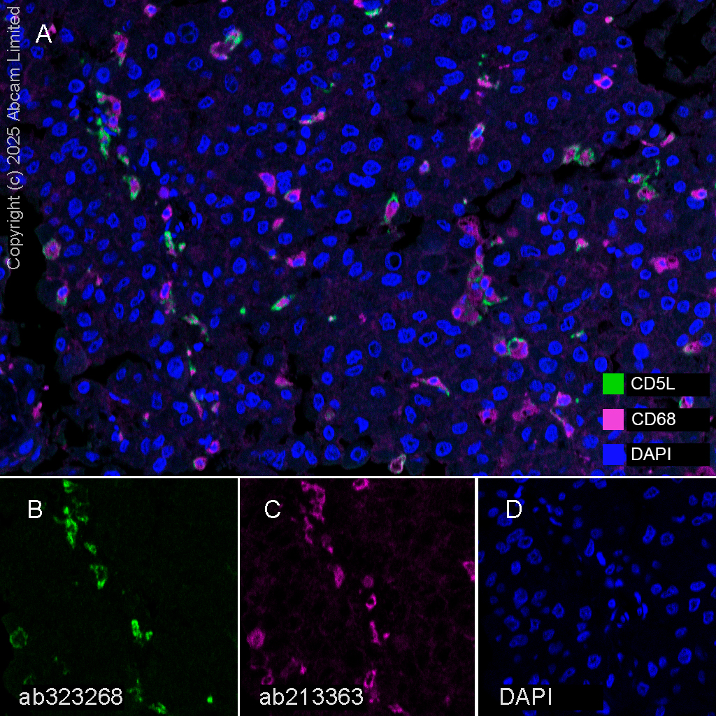 Multiplex immunohistochemistry - Anti-CD68 antibody [EPR20545] (ab213363), expandable thumbnail