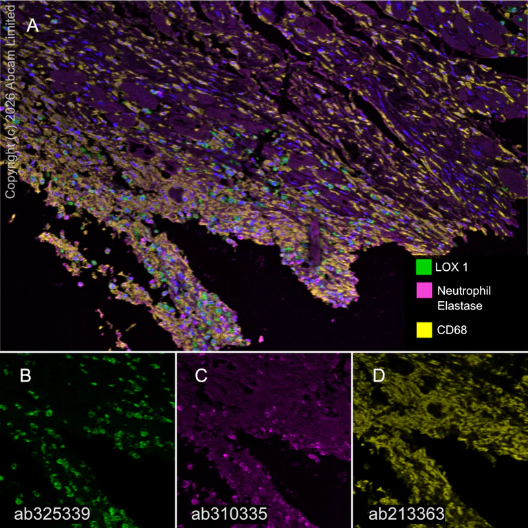 Multiplex immunohistochemistry - Anti-CD68 antibody [EPR20545] (AB213363)