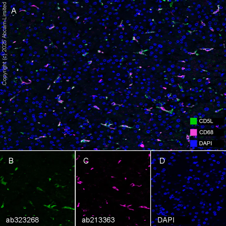 Multiplex immunohistochemistry - Anti-CD68 antibody [EPR20545] - BSA and Azide free (AB227458)
