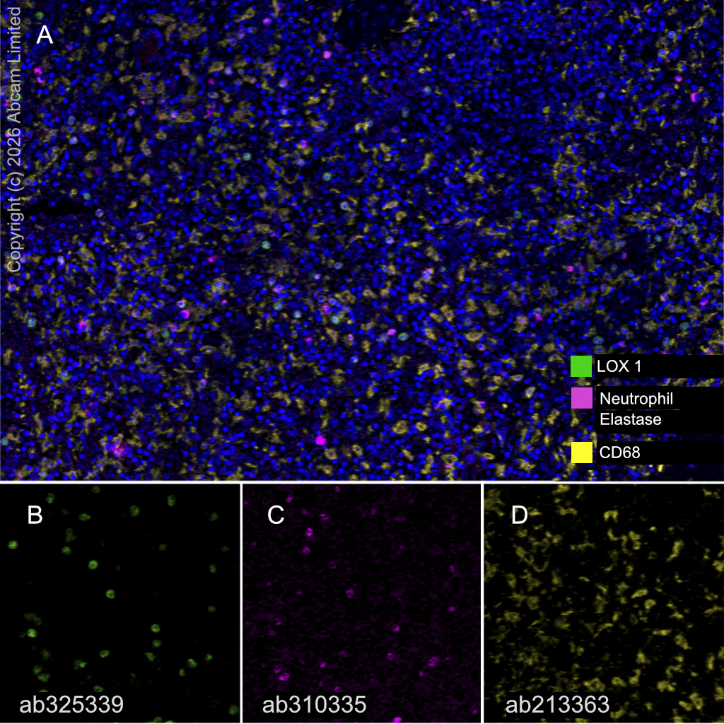 Multiplex immunohistochemistry - Anti-CD68 antibody [EPR20545] - BSA and Azide free (AB227458)