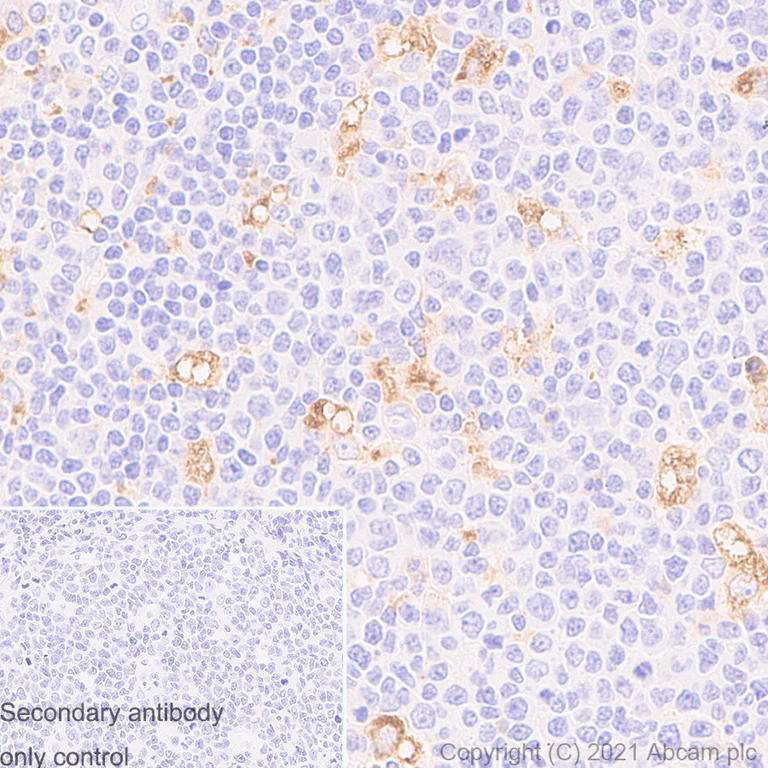 Immunohistochemistry (Formalin/PFA-fixed paraffin-embedded sections) - Anti-CD68 antibody [EPR20545] - Goat IgG (Chimeric) - BSA and Azide free (AB289677)