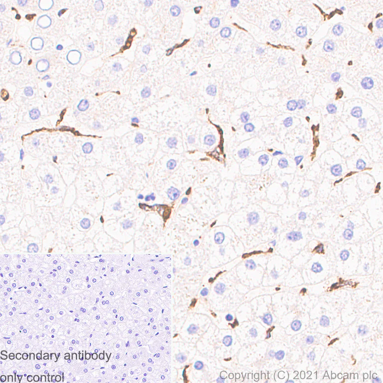 Immunohistochemistry (Formalin/PFA-fixed paraffin-embedded sections) - Anti-CD68 antibody [EPR20545] - Goat IgG (Chimeric) - BSA and Azide free (AB289677)