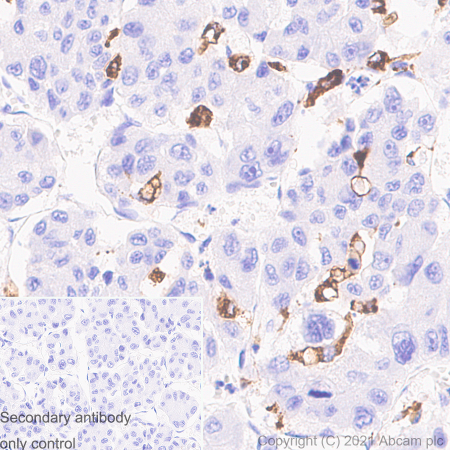 Immunohistochemistry (Formalin/PFA-fixed paraffin-embedded sections) - Anti-CD68 antibody [EPR20545] - Mouse IgG1 (Chimeric) (AB283316), expandable thumbnail
